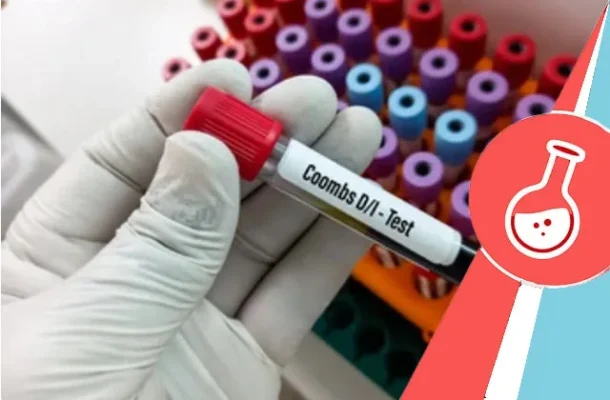 Nghiệm-pháp-Coombs-hematolab