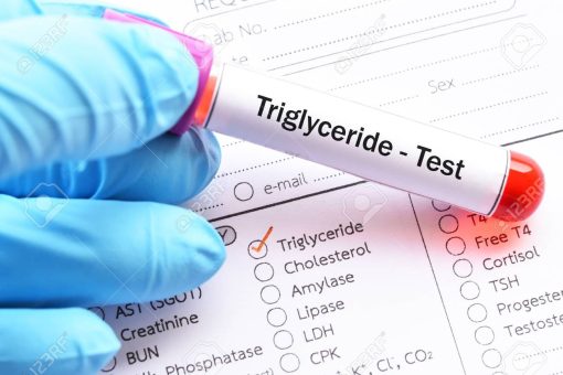 Định lượng Triglyceride