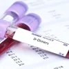 Xét nghiệm Định lượng D-Dimer