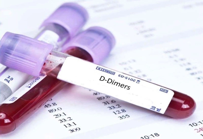 Xét nghiệm Định lượng D-Dimer
