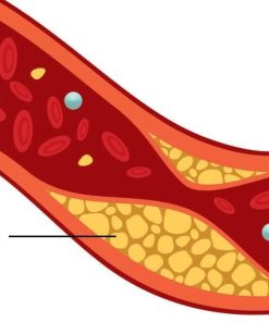 Định lượng Cholesterol
