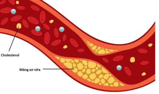 Định lượng Cholesterol