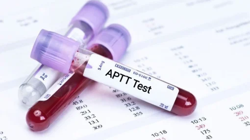 Xét nghiệm APTT
