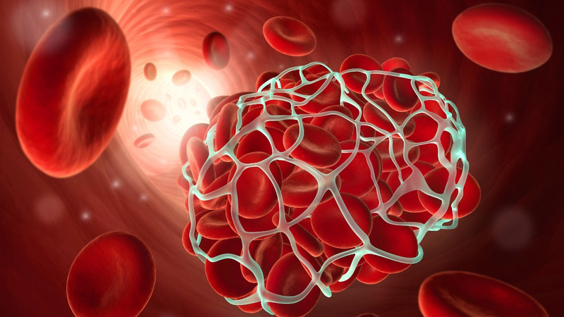 Xét nghiệm đông máu