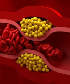 Xét nghiệm LDL- Cholesterol