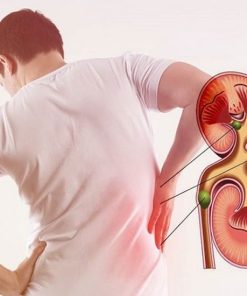 Xét nghiệm Ure máu