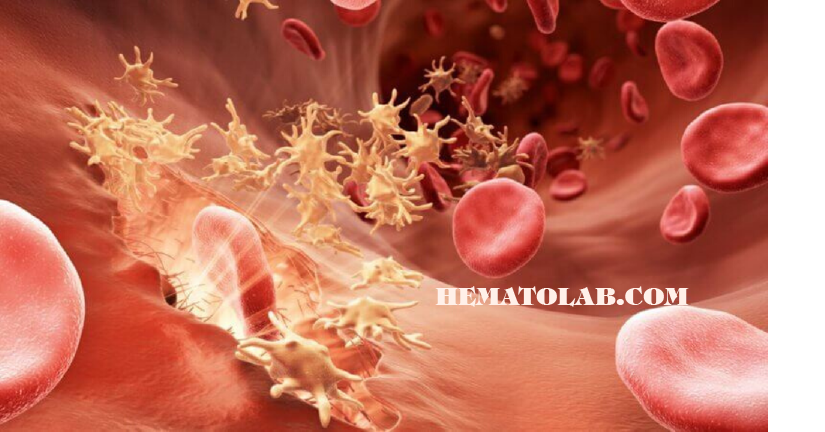 Xét nghiệm huyết học