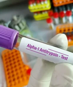 Xét nghiệm Alpha-1 antitrypsin (AAT)