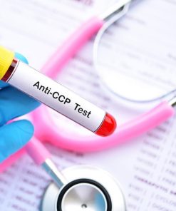 Xét nghiệm Anti-CCP chuẩn đoán viêm khớp dạng thấp