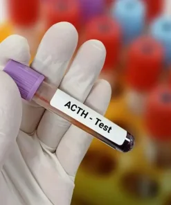 Xét nghiệm định lượng ACTH máu