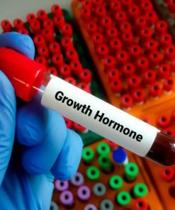 Xét nghiệm định lượng Growth Hormone