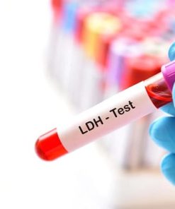 Xét nghiệm đo hoạt độ LDH