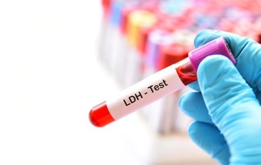 Xét nghiệm đo hoạt độ LDH