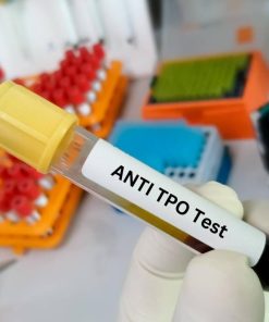 Xét nghiệm Anti-TPO chuẩn đoán bệnh lý tuyến giáp tự miễn