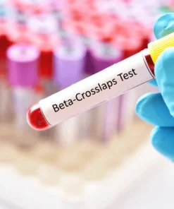 Xét nghiệm Beta CrossLaps