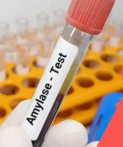 Xét nghiệm Amylase chuẩn đoán bệnh liên quan đến tụy cấp và mãn tính, sỏi mật