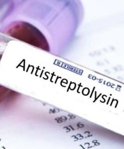 Xét nghiệm định lượng ASLO (Antistreptolysin O)