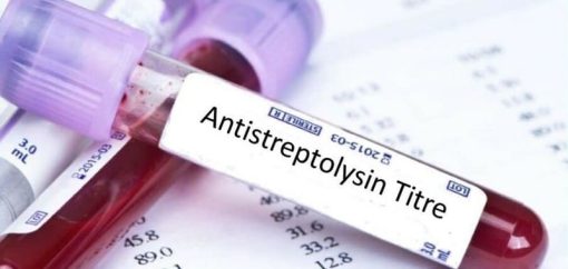 Xét nghiệm định lượng ASLO (Antistreptolysin O)