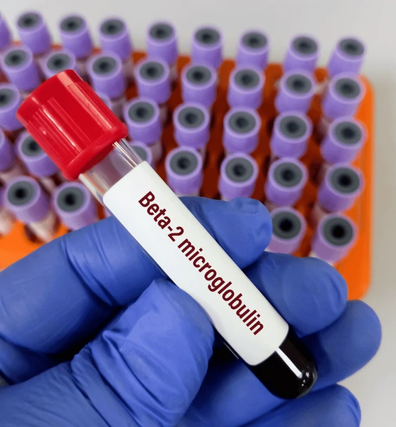 Xét nghiệm chuẩn đoán bệnh thận và ung thư β2-microglobulin