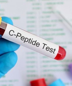 Xét nghiệm C-Peptide C-Peptide