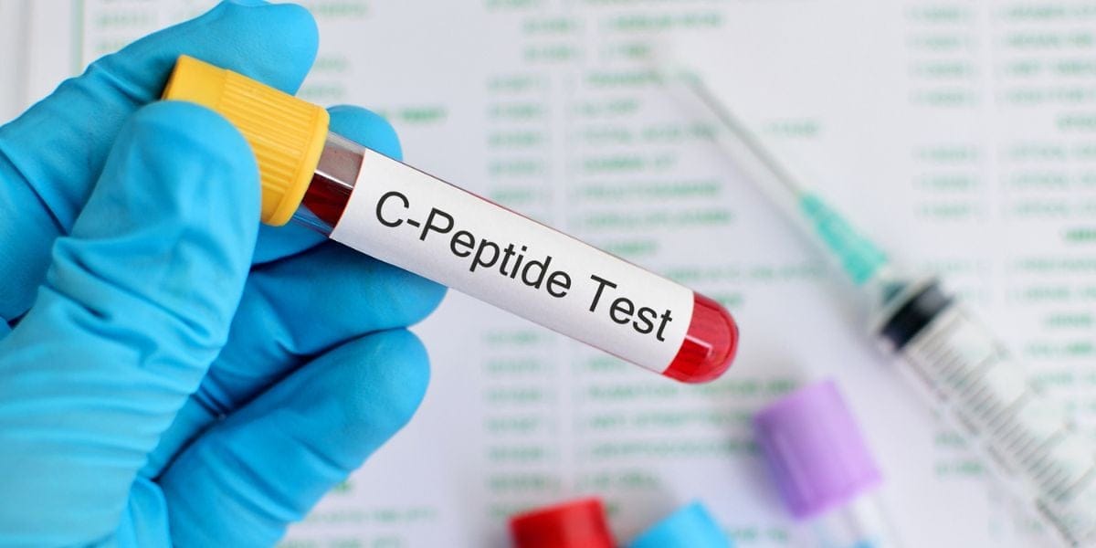 Xét nghiệm C-Peptide C-Peptide