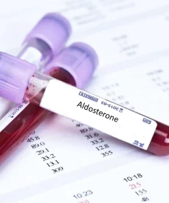 Xét nghiệm định lượng Aldosterone (máu)