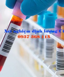 Xét nghiệm định lượng C4