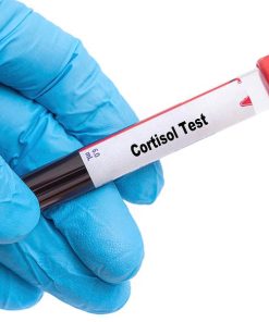 Xét nghiệm định lượng Cortisol máu
