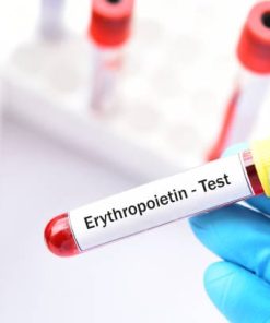 Xét nghiệm định lượng Erythropoietin (EPO)