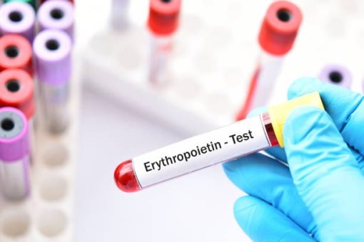 Xét nghiệm định lượng Erythropoietin (EPO)