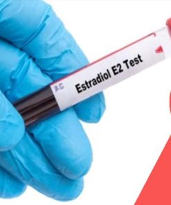 Xét nghiệm định lượng Estradiol E2