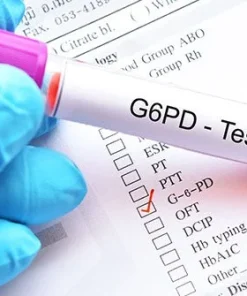 Xét nghiệm định lượng G6PD (máu)