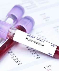 Xét nghiệm định lượng Homocysteine toàn phần