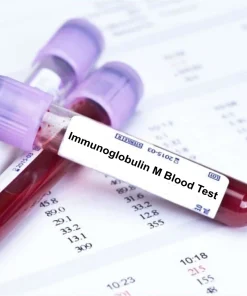 Xét nghiệm định lượng IgM