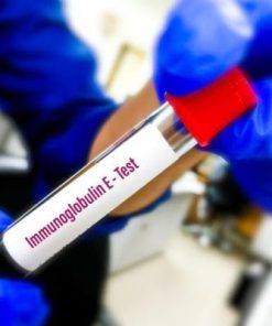 Xét nghiệm định lượng IgE