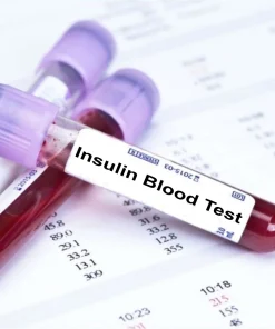 Xét nghiệm định lượng Insulin máu