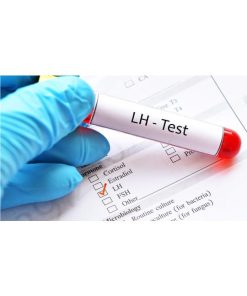 Xét nghiệm định lượng Luteinizing Hormone (LH)
