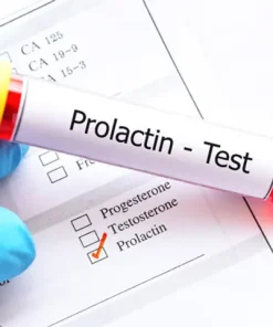 Xét nghiệm định lượng Prolactin