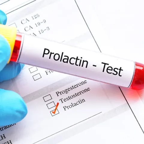 Xét nghiệm định lượng Prolactin