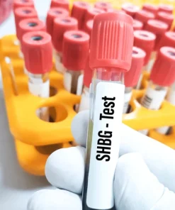 Xét nghiệm định lượng SHBG
