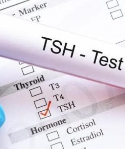 Xét nghiệm định lượng TSH tuyến giáp