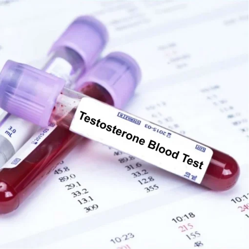 Xét nghiệm định lượng Testosterone