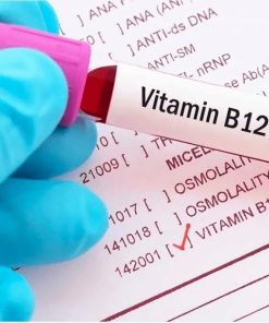 Xét nghiệm định lượng vitamin B12