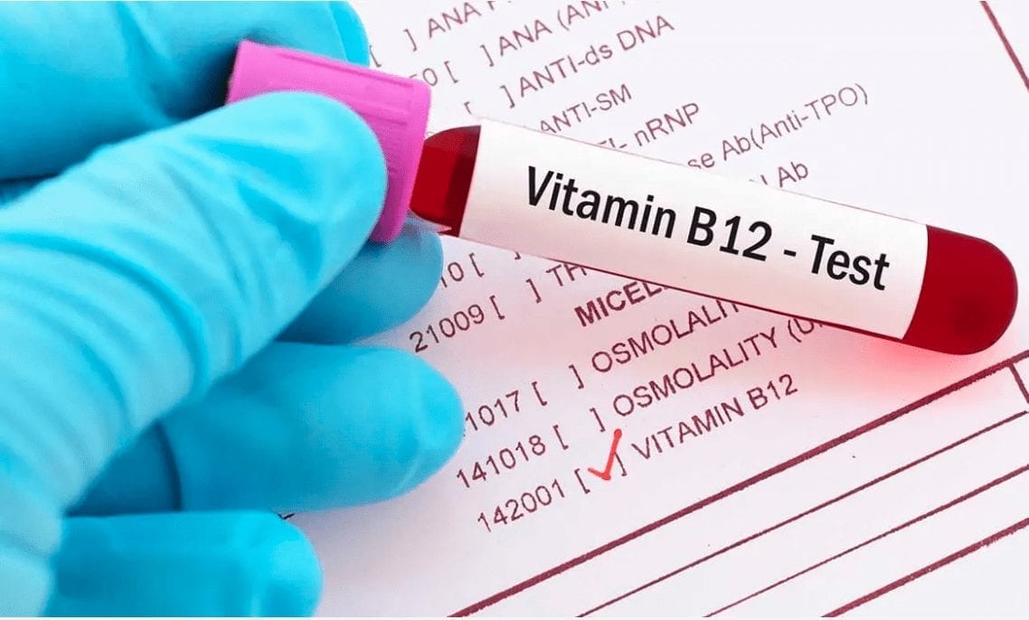 Định Lượng Vitamin B12: Hướng Dẫn Chi Tiết và Quan Trọng