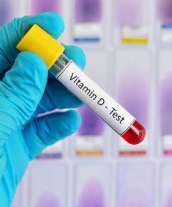 Xét nghiệm định lượng Vitamin D