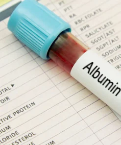 Xét nghiệm định lượng albumin trong máu