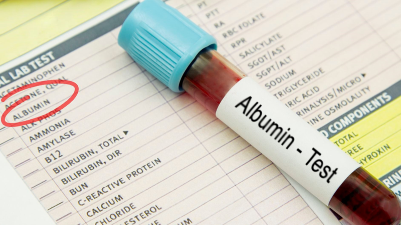 Xét nghiệm định lượng albumin trong máu