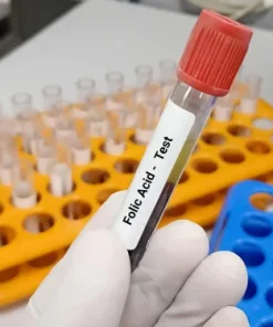 Xét nghiệm định lượng Acid Folic