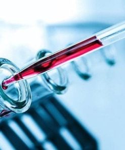 Xét nghiệm định lượng Phospho (máu)