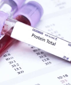 Xét nghiệm protein toàn phần